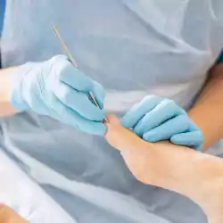 Ingrowing Toenails and Nail Surgery